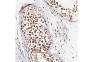 Immunohistochemical staining of human testis with WDR25 polyclonal antibody  shows strong nuclear positivity in bone marrow poietic cells at 1:50-1:200 dilution.