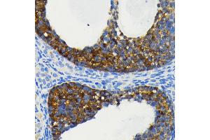 anti-Baculoviral IAP Repeat Containing 2 (BIRC2) antibody