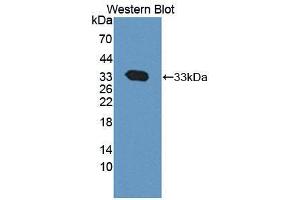 Western blot analysis of the recombinant protein. (CAPNL1 anticorps  (AA 75-356))