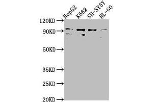 Western Blot Positive WB detected in: HepG2 whole cell lysate, K562 whole cell lysate, SH-SY5Y whole cell lysate, HL-60 whole cell lysate All lanes: NUGGC antibody at 1:2000 Secondary Goat polyclonal to rabbit IgG at 1/50000 dilution Predicted band size: 92 kDa Observed band size: 92 kDa (C8orf80 anticorps  (AA 1-228))