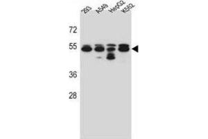 Western Blotting (WB) image for anti-Tubulin, beta 8 (TUBB8) antibody (ABIN2997238) (Tubulin, beta 8 anticorps)