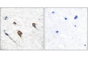 Immunohistochemistry analysis of paraffin-embedded human brain, using IL-3R beta (Phospho-Tyr593) Antibody. (CSF2RB2 anticorps  (pTyr593))