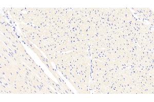 Detection of CTGF in Human Cardiac Muscle Tissue using Polyclonal Antibody to Connective Tissue Growth Factor (CTGF)