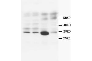 Western Blotting (WB) image for anti-Calbindin (CALB1) antibody (ABIN1105634) (CALB1 anticorps)