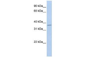 SLFNL1 antibody used at 1 ug/ml to detect target protein. (Schlafen-Like 1 anticorps  (Middle Region))