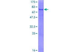 Image no. 1 for Acid Phosphatase 6, Lysophosphatidic (ACP6) (AA 1-428) protein (GST tag) (ABIN1305689)