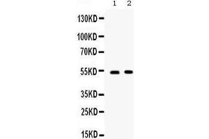 Western blot analysis of CD134/OX40 expression in SW620 whole cell lysates (lane 1) and 22RV1 whole cell lysates (lane 1).