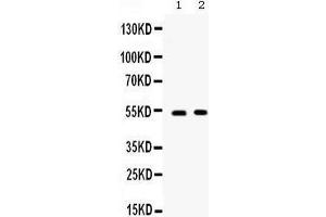 Western blot analysis of CD134/OX40 expression in SW620 whole cell lysates (lane 1) and 22RV1 whole cell lysates (lane 1).