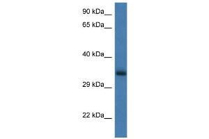 WB Suggested Anti-Gnpda1 Antibody   Titration: 1. (GNPDA1 anticorps  (N-Term))