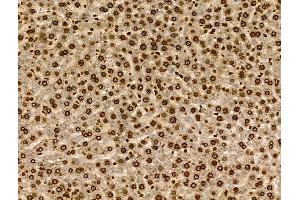 Phospho-SGK1 (Ser78) Antibody at 1/100 staining Rat liver tissue by IHC-P. (SGK1 anticorps  (pSer78))