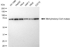 Western blotting analysis using Methylmalonyl-CoA mutase antibody (ABIN7799395). (Recombinant MUT anticorps)