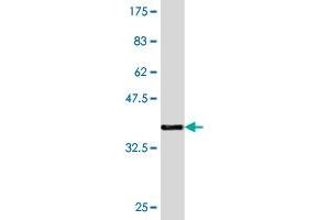 Western Blot detection against Immunogen (36. (T-Bet anticorps  (AA 387-486))