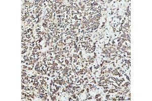 IHC analysis of EEA1 using anti-EEA1 antibody (ABIN5692856). (EEA1 anticorps)