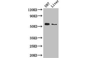 Western Blot Positive WB detected in: U87 whole cell lysate, Mouse liver tissue All lanes: ALDH1A3 antibody at 3 μg/mL Secondary Goat polyclonal to rabbit IgG at 1/50000 dilution Predicted band size: 57 kDa Observed band size: 57 kDa
