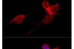 Confocal immunofluorescence analysis of HeLa cells using RPL36 Polyclonal Antibody at dilution of 1:200.