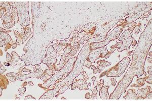 Immunohistochemistry of paraffin-embedded Human placenta using FGG Polycloanl Antibody at dilution of 1:200 (FGG anticorps)