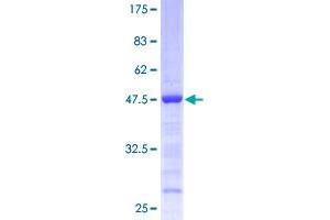 Eukaryotic Translation Initiation Factor 1A, Y-Linked (EIF1AY) (AA 1-144) protein (GST tag)