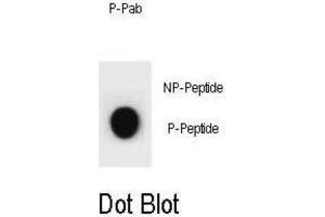 Dot Blot (DB) image for anti-Cyclin B2 (CCNB2) (pSer392) antibody (ABIN3002074) (Cyclin B2 anticorps  (pSer392))