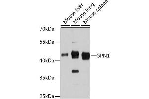 Western blot analysis of extracts of various cell lines, using GPN1 antibody (ABIN6133308, ABIN6141341, ABIN6141342 and ABIN6215758) at 1:3000 dilution. (GPN1 anticorps  (AA 269-388))