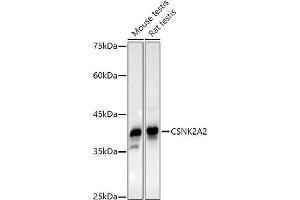 Western blot analysis of extracts of various cell lines, using CSNK2 antibody (0791) at 1:1000 dilution. (CSNK2A2 anticorps)