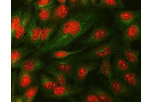 IF analysis of Daxx using anti-Daxx antibody (ABIN3043822) and anti-Tubulin Alpha antibody (ABIN7600339).