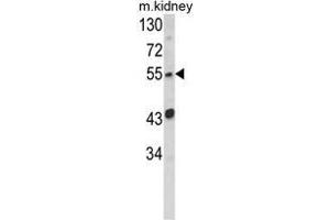 Western blot analysis of SIL1 Antibody (Center) in mouse kidney tissue lysates (35ug/lane). (SIL1 anticorps  (Middle Region))
