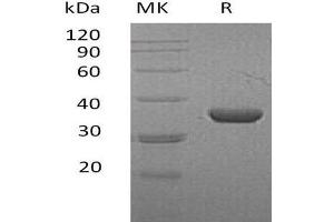 Western Blotting (WB) image for Lactate Dehydrogenase A (LDHA) protein (His tag) (ABIN7320609)
