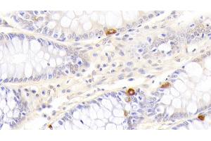 Detection of DR5 in Human Colon Tissue using Polyclonal Antibody to Death receptor 5 (DR5)