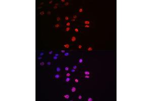 Immunofluorescence analysis of NIH-3T3 cells using Phospho-p70 S6 Kinase 1-T421/S424 antibody (ABIN6135340, ABIN6136296, ABIN6136297 and ABIN7101878).