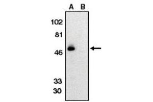 Image no. 1 for anti-Chemokine (C-X3-C Motif) Receptor 1 (CX3CR1) (AA 175-189) antibody (ABIN265002) (CX3CR1 anticorps  (AA 175-189))