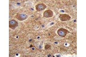 PAK6 antibody immunohistochemistry analysis in formalin fixed and paraffin embedded human brain tissue.