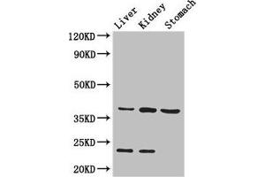 Western Blot Positive WB detected in: Mouse liver tissue, Mouse kidney tissue, Mouse stomach tissue All lanes: Akr1a1 antibody at 2. (AKR1A1 anticorps  (AA 2-325))