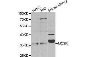 Western blot analysis of extracts of 293 cell lysate, using MC2R antibody. (MC2R anticorps)
