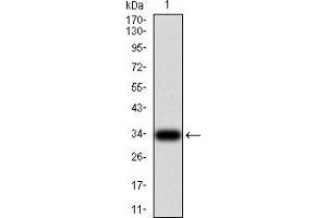 Western blot analysis using NS1 mAb against human Parvovirus NS1 (AA: 1-216) recombinant protein. (Parvovirus B19 NS1 (AA 1-216) anticorps)