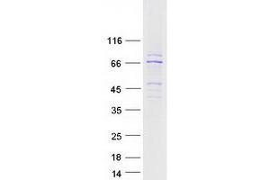 Validation with Western Blot
