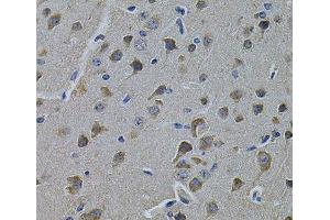 Immunohistochemistry of paraffin-embedded Rat brain using ERBB3 Polyclonal Antibody at dilution of 1:100 (40x lens). (ERBB3 anticorps)