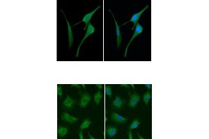 ICC/IF analysis of CSTB in U87MG cells line, stained with DAPI (Blue) for nucleus staining and monoclonal anti-human CSTB antibody (1:100) with goat anti-mouse IgG-Alexa fluor 488 conjugate (Green).
