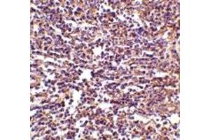 Immunohistochemistry (IHC) image for anti-CD180 Molecule (CD180) (Middle Region) antibody (ABIN1031073) (CD180 anticorps  (Middle Region))