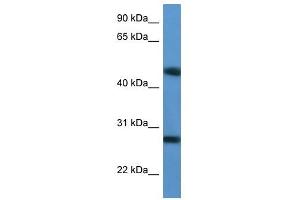 Western Blot showing TM2D2 antibody used at a concentration of 1-2 ug/ml to detect its target protein. (TM2D2 anticorps  (Middle Region))