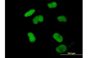 Immunofluorescence of purified MaxPab antibody to ZNF502 on HeLa cell. (ZNF502 anticorps  (AA 1-544))