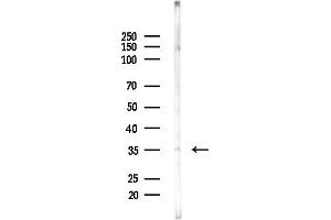 anti-Xylosylprotein beta 1,4-Galactosyltransferase, Polypeptide 7 (Galactosyltransferase I) (B4GALT7) antibody