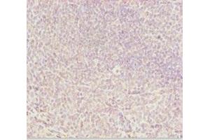 Immunohistochemistry of paraffin-embedded human tonsil tissue using ABIN7144962 at dilution of 1:100 (DDX11 anticorps  (AA 1-220))