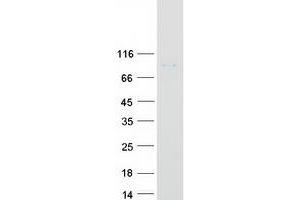 Validation with Western Blot