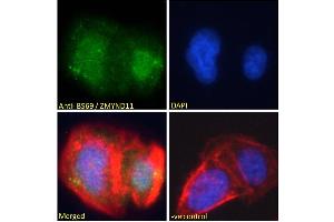 ABIN184908 Immunofluorescence analysis of paraformaldehyde fixed U2OS cells, permeabilized with 0. (ZMYND11 anticorps  (N-Term))