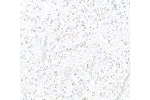 Immunohistochemistry (IHC) image for anti-SRY (Sex Determining Region Y)-Box 2 (SOX2) antibody (ABIN7449421)
