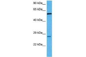 Host:  Mouse  Target Name:  RBPJ  Sample Tissue:  Mouse Liver  Antibody Dilution:  1ug/ml (RBPJ anticorps  (C-Term))