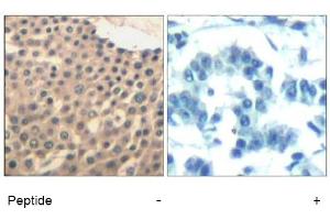 Image no. 1 for anti-HDAC4,HDAC5,HDAC9 (Ser220), (Ser246), (Ser259) antibody (ABIN319389)