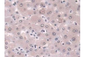 Detection of LMP7 in Human Liver Tissue using Polyclonal Antibody to Large Multifunctional Peptidase 7 (LMP7)