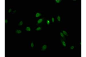Immunofluorescence staining of Hela cells with ABIN7158383 at 1:100, counter-stained with DAPI. (LHX2 anticorps  (AA 197-377))