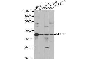 Western blot analysis of extracts of various cell lines, using RPLP0 antibody (ABIN6290910) at 1:1000 dilution. (RPLP0 anticorps)